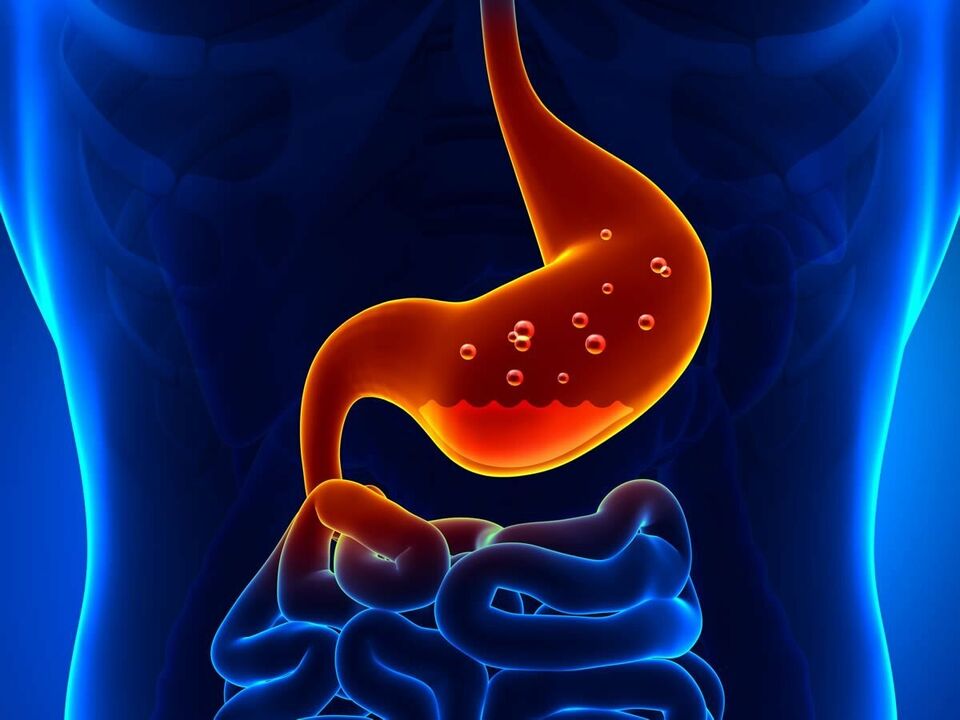 Gastritis je vnetna bolezen želodca, ki zahteva dieto